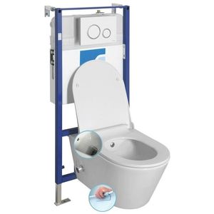SAPHO - Závesné WC AVVA CLEANWASH, integr. batéria a bidet. sprška s podomietkovou nádržkou a tlačidlom Schwab, biela 100315-SET5 vyobraziť